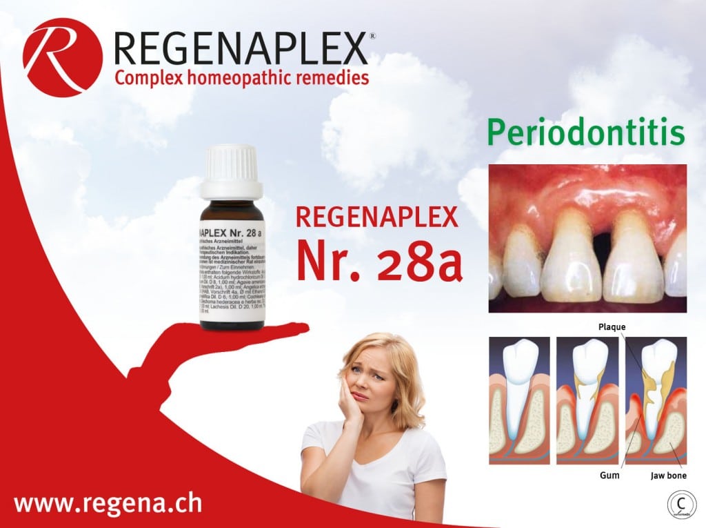 REGENAPLEX Nr 28a - Periodontitis